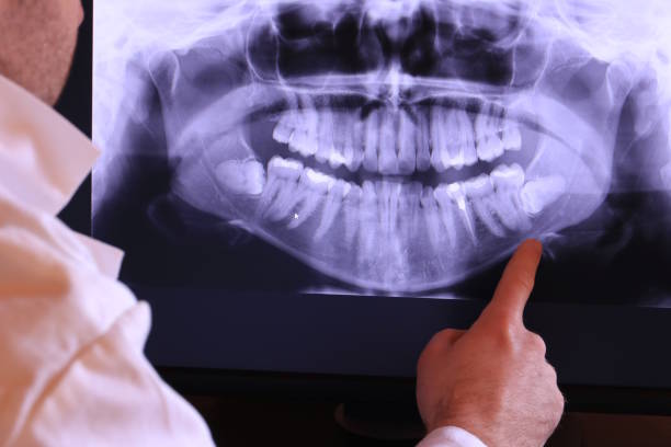 Best Emergency Dentist for Lost Fillings or Crowns in Garden City South, NY
