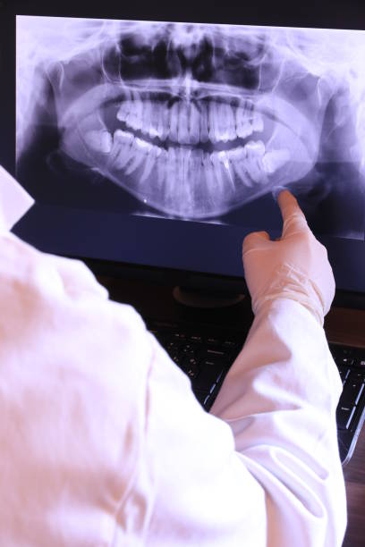 Best Emergency Dentist for Lost Fillings or Crowns in Garden City South, NY